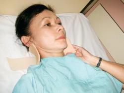 Woman putting on Philadelphia neck collar