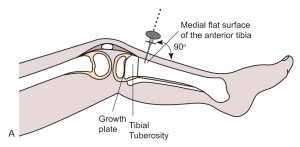 Intraosseous access of tibia anatomy